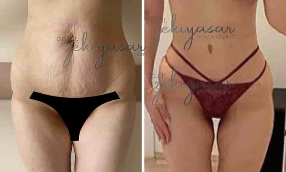 Подтвержденные отзывы пациентов о Dr. Zeki Yasar Clinic в Istanbul, Turkey Slider image 5