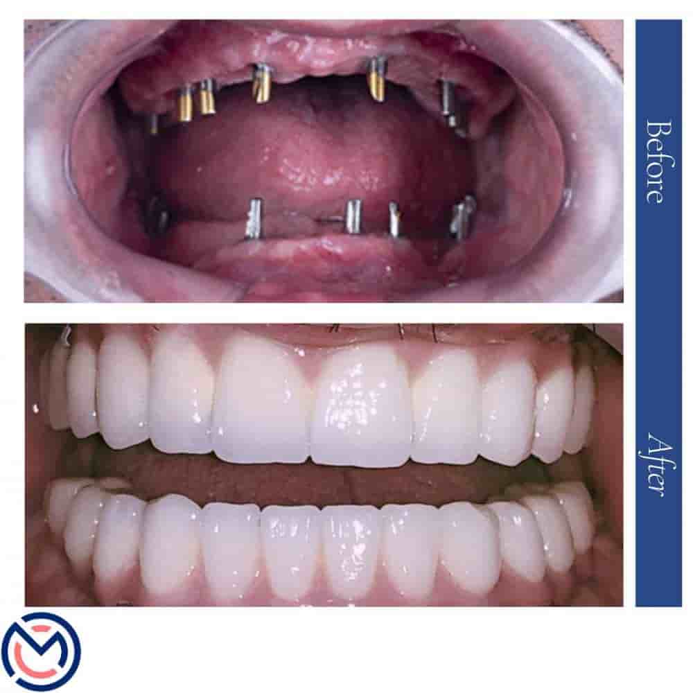Подтвержденные отзывы пациентов о Medicall Me в Istanbul, Turkey Slider image 7