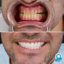 Подтвержденные отзывы пациентов о Turkiye Dental в , Turkey Slider image 3
