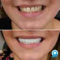 Подтвержденные отзывы пациентов о Turkiye Dental в , Turkey Slider image 4