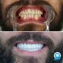 Подтвержденные отзывы пациентов о Turkiye Dental в , Turkey Slider image 5