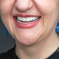 Подтвержденные отзывы пациентов о Turkiye Dental в , Turkey Slider image 7
