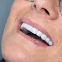 Подтвержденные отзывы пациентов о Turkiye Dental в , Turkey Slider image 10