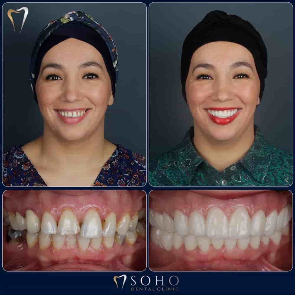 Подтвержденные отзывы пациентов о Soho Dental Clinic в Istanbul, Turkey Slider image 3