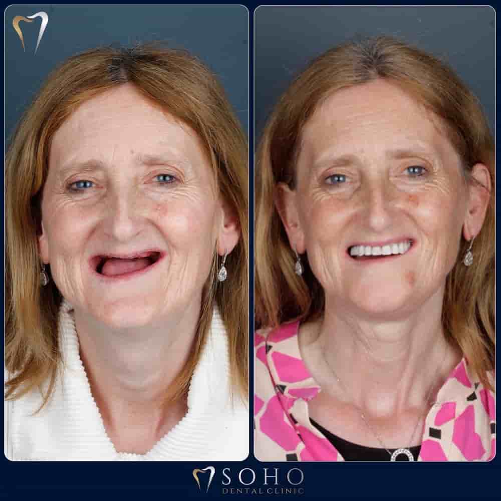 Подтвержденные отзывы пациентов о Soho Dental Clinic в Istanbul, Turkey Slider image 4