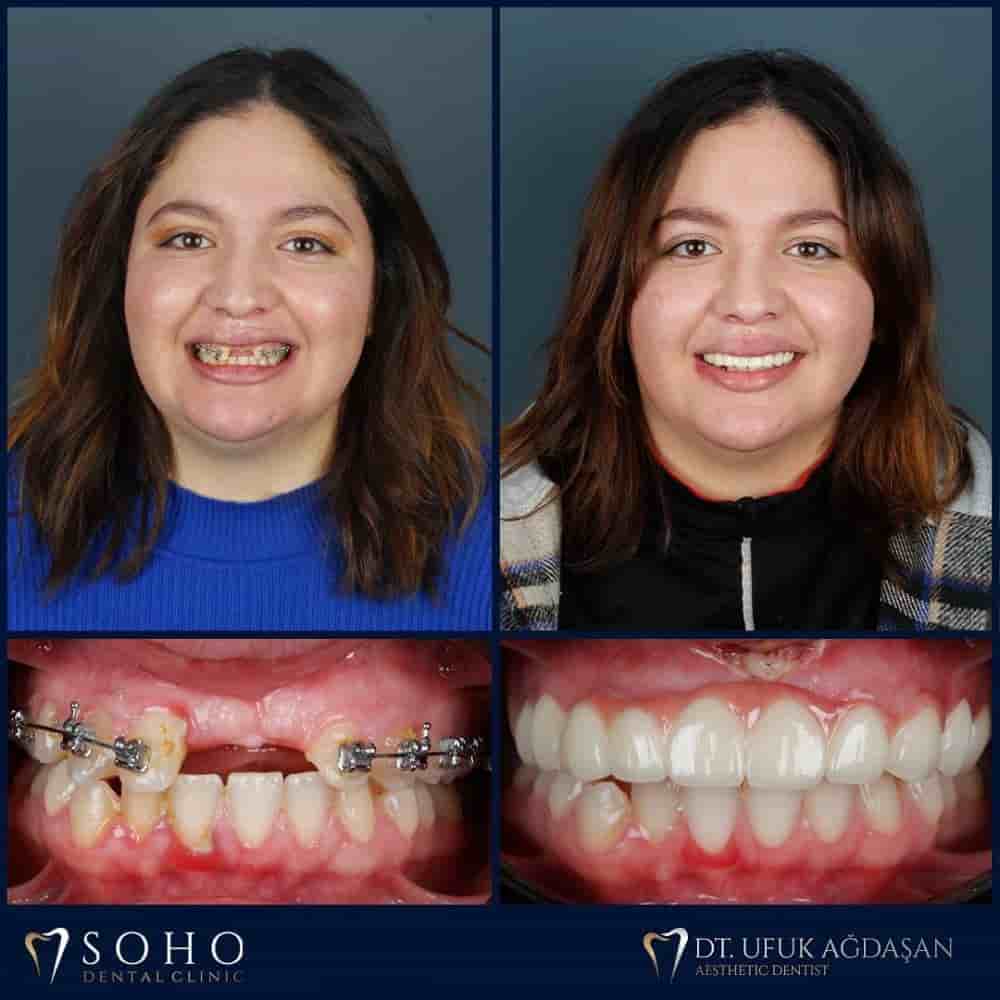 Подтвержденные отзывы пациентов о Soho Dental Clinic в Istanbul, Turkey Slider image 7