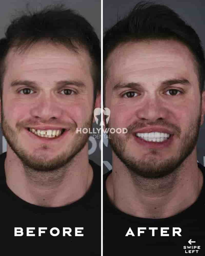Подтвержденные отзывы пациентов о Hollywood Dental Izmir Turkey в Izmir, Turkey Slider image 1