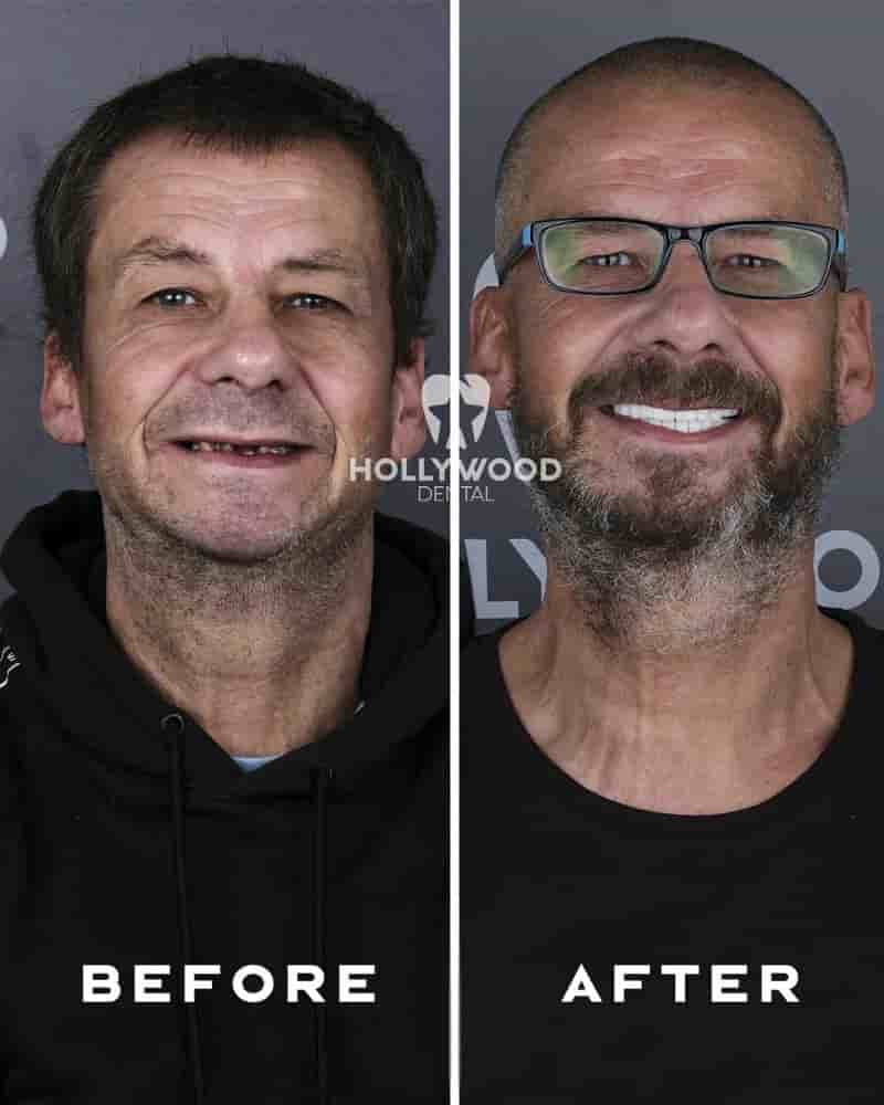 Подтвержденные отзывы пациентов о Hollywood Dental Izmir Turkey в Izmir, Turkey Slider image 2