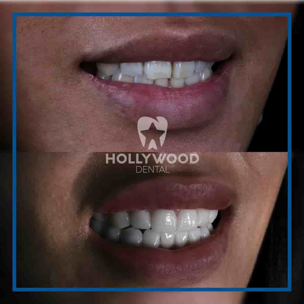 Подтвержденные отзывы пациентов о Hollywood Dental Izmir Turkey в Izmir, Turkey Slider image 5