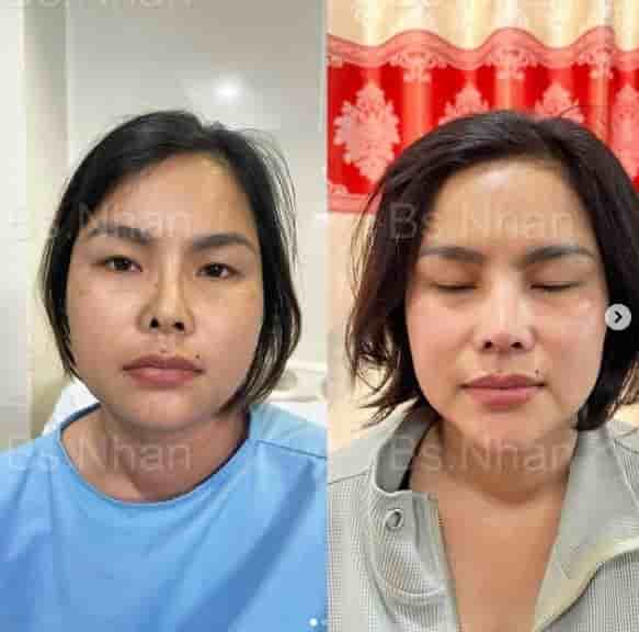 Подтвержденные отзывы пациентов о Dr. Nhan Ho Aesthetics and Plastic Surgery в Ho Chi Minh, Vietnam Slider image 1