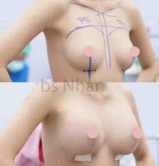 Подтвержденные отзывы пациентов о Dr. Nhan Ho Aesthetics and Plastic Surgery в Ho Chi Minh, Vietnam Slider image 2