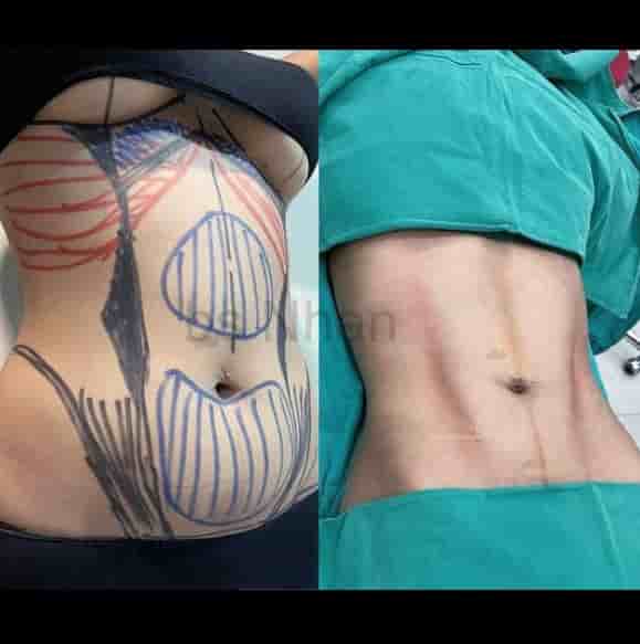 Подтвержденные отзывы пациентов о Dr. Nhan Ho Aesthetics and Plastic Surgery в Ho Chi Minh, Vietnam Slider image 3