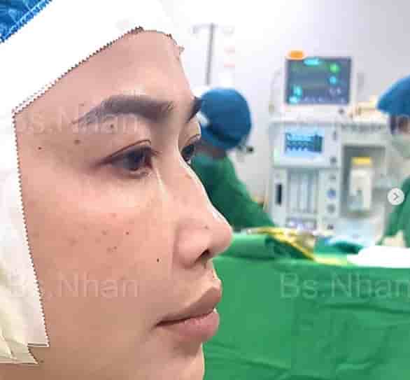 Подтвержденные отзывы пациентов о Dr. Nhan Ho Aesthetics and Plastic Surgery в Ho Chi Minh, Vietnam Slider image 6