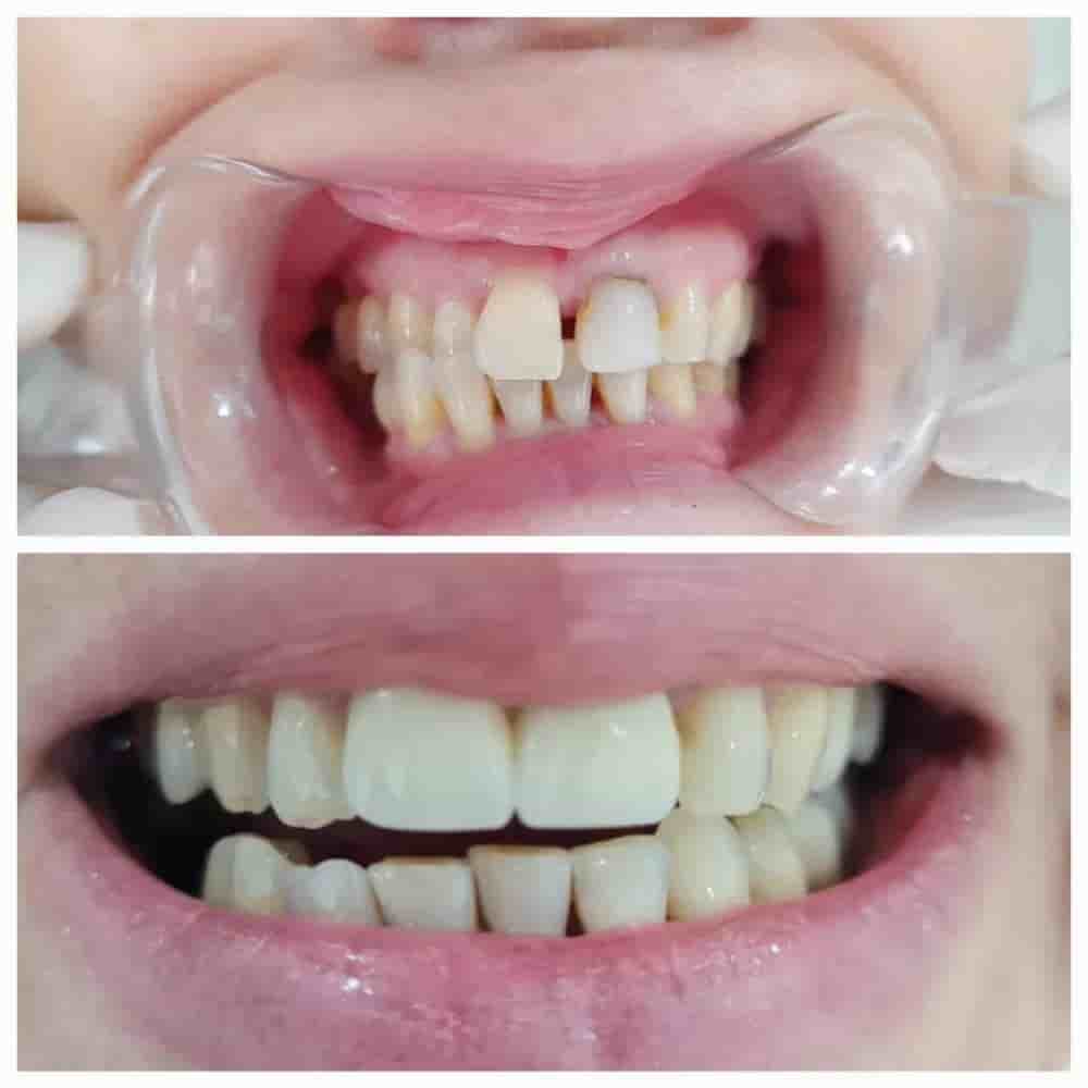 Подтвержденные отзывы пациентов о Prestij Dental Clinic в Antalya, Turkey Slider image 6