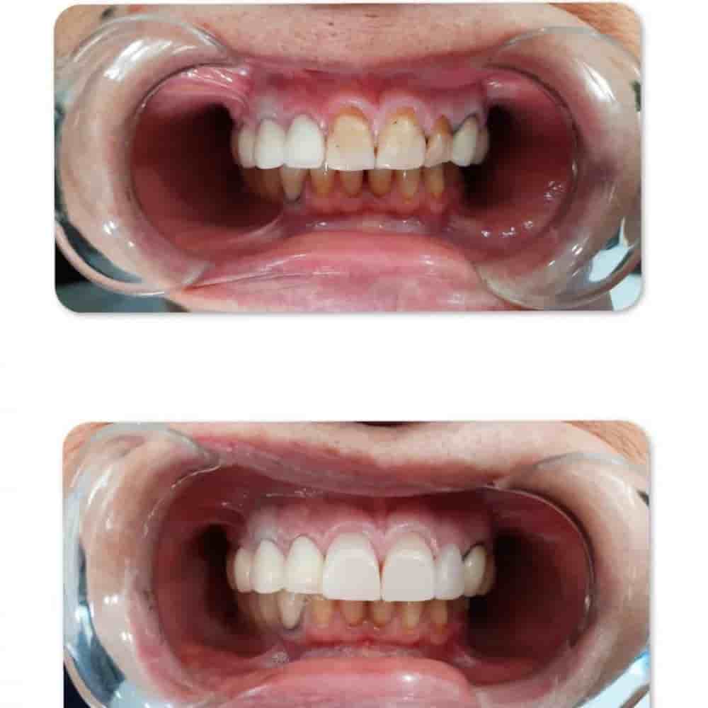 Подтвержденные отзывы пациентов о Prestij Dental Clinic в Antalya, Turkey Slider image 7