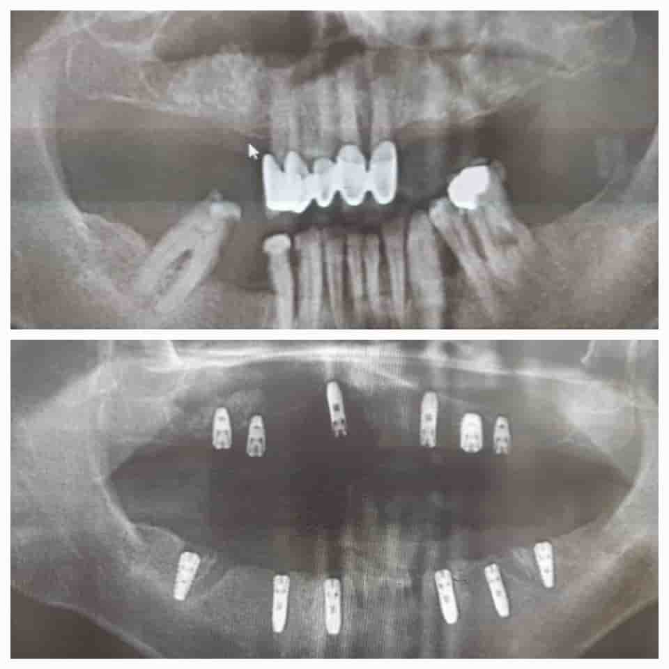 Подтвержденные отзывы пациентов о Prestij Dental Clinic в Antalya, Turkey Slider image 8