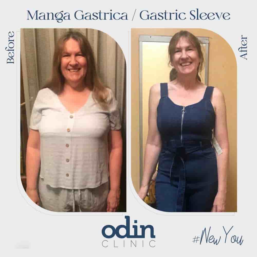 Подтвержденные отзывы пациентов о Odin Clinic в Izmir, Turkey Slider image 2