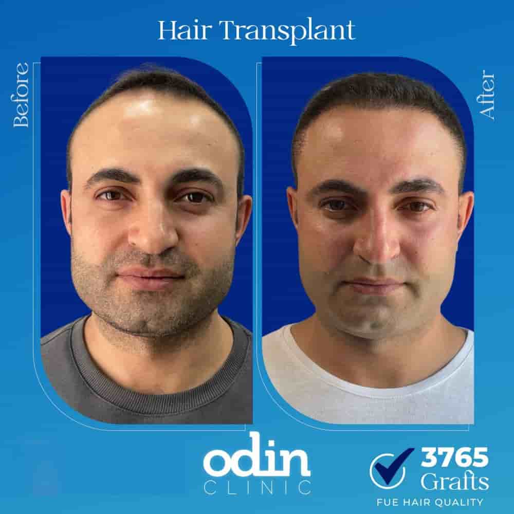 Подтвержденные отзывы пациентов о Odin Clinic в Izmir, Turkey Slider image 3