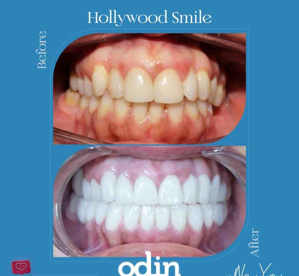 Подтвержденные отзывы пациентов о Odin Clinic в Izmir, Turkey Slider image 5