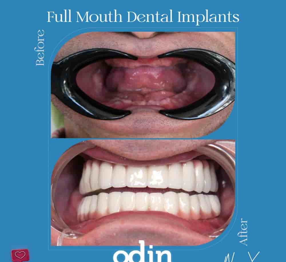 Подтвержденные отзывы пациентов о Odin Clinic в Izmir, Turkey Slider image 6