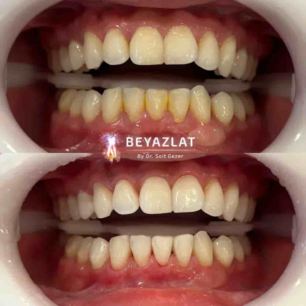 Подтвержденные отзывы пациентов о Dr. Sait Gezer в Istanbul, Turkey Slider image 8