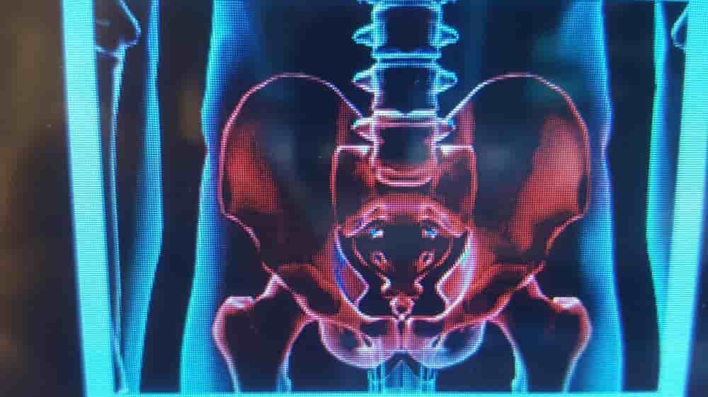 Подтвержденные отзывы пациентов о Klinik Piano в Biel, Switzerland Slider image 7