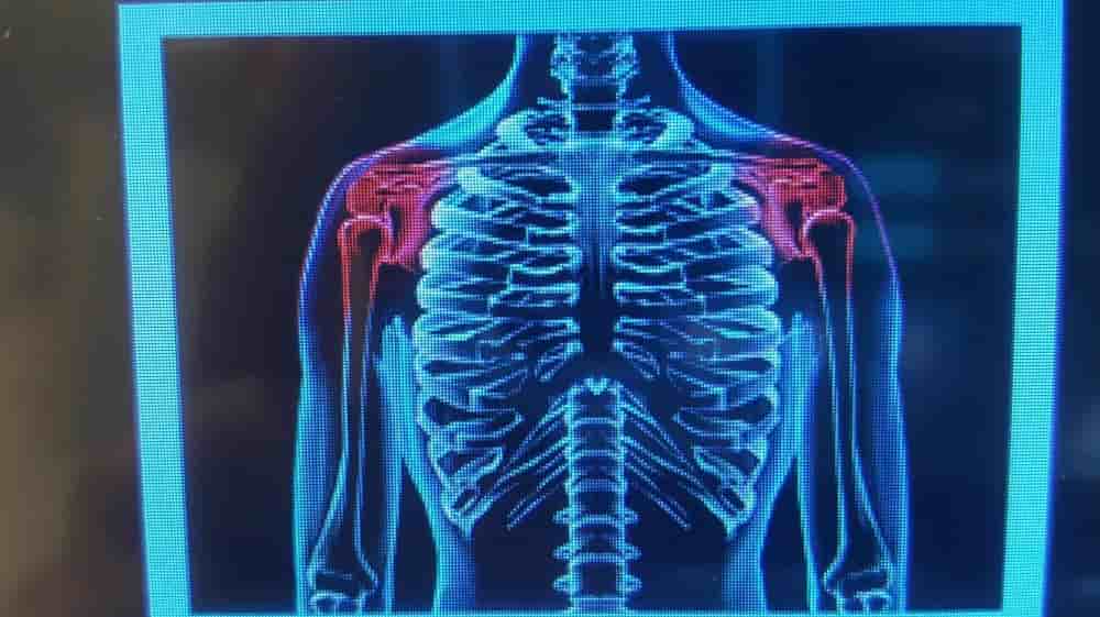 Подтвержденные отзывы пациентов о Klinik Piano в Biel, Switzerland Slider image 8