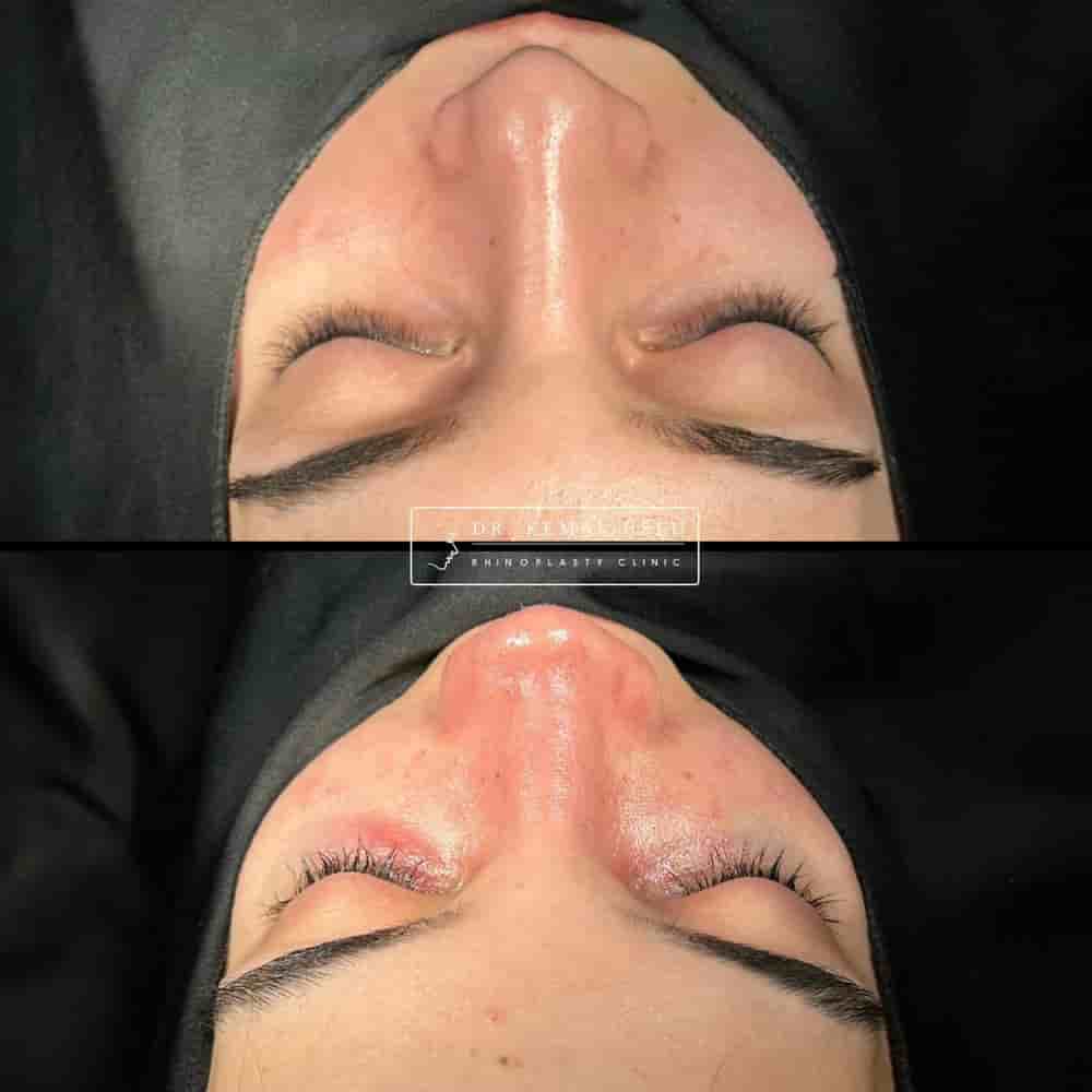 Подтвержденные отзывы пациентов о Dr. Kemal Uslu Clinic в Istanbul, Turkey Slider image 3