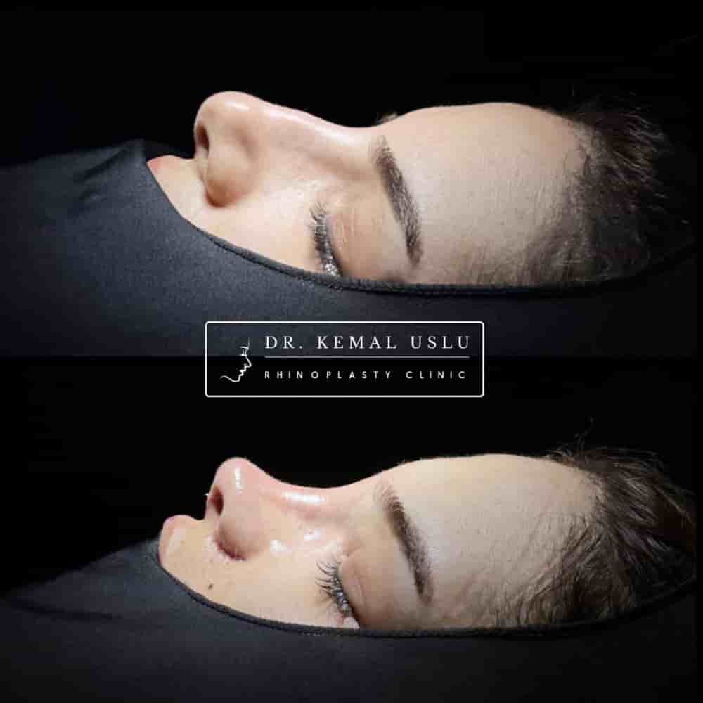 Подтвержденные отзывы пациентов о Dr. Kemal Uslu Clinic в Istanbul, Turkey Slider image 5