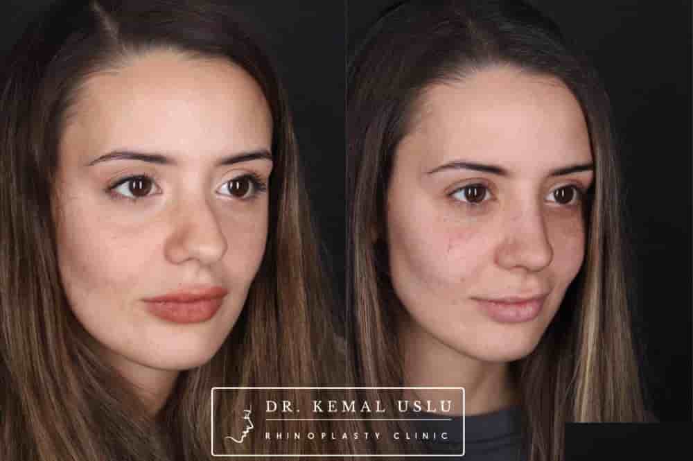 Подтвержденные отзывы пациентов о Dr. Kemal Uslu Clinic в Istanbul, Turkey Slider image 6