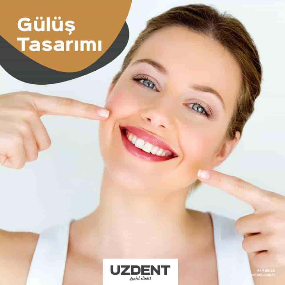 Подтвержденные отзывы пациентов о Uzdent Dental Clinics в Istanbul,Kayseri,Nevsehir, Turkey Slider image 3