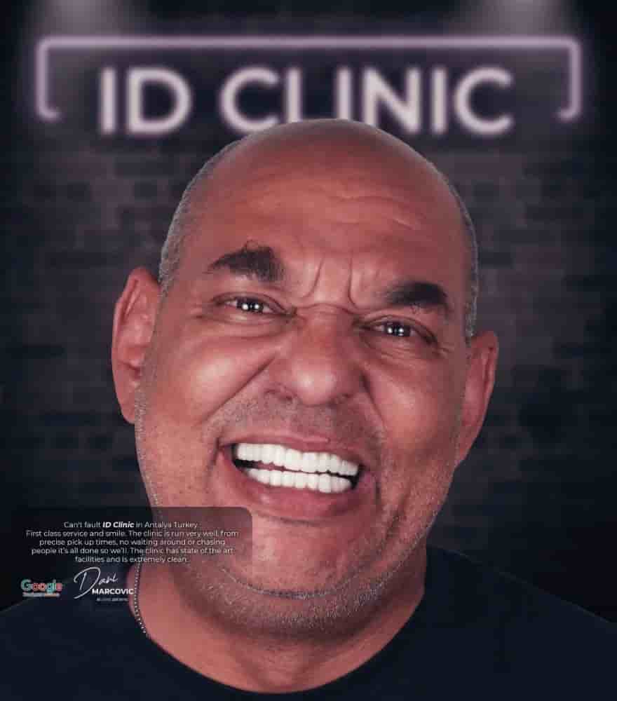 Подтвержденные отзывы пациентов о IDC International Dental Clinic в Antalya, Turkey Slider image 4
