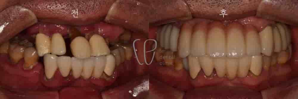 Подтвержденные отзывы пациентов о Le Dental Clinic в Seoul, South Korea Slider image 2