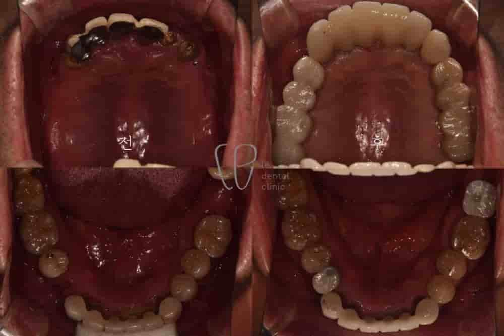 Подтвержденные отзывы пациентов о Le Dental Clinic в Seoul, South Korea Slider image 3