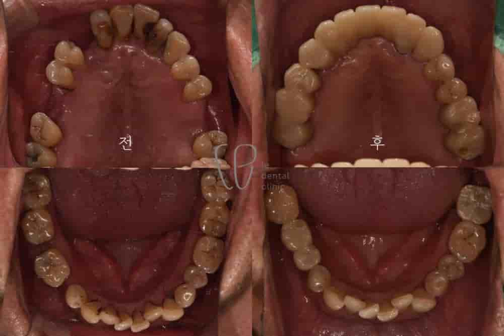 Подтвержденные отзывы пациентов о Le Dental Clinic в Seoul, South Korea Slider image 4