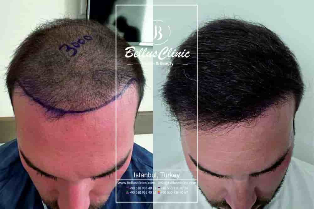 Подтвержденные отзывы пациентов о Bellus Clinic в Istanbul, Turkey Slider image 6