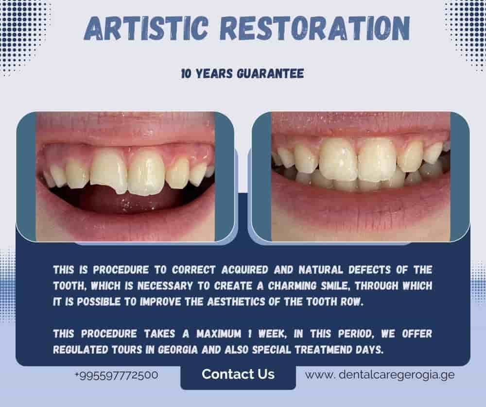 Подтвержденные отзывы пациентов о Universe Dental - Best Dental Clinic in Tbilisi, Georgia в Tbilisi, Georgia Slider image 2