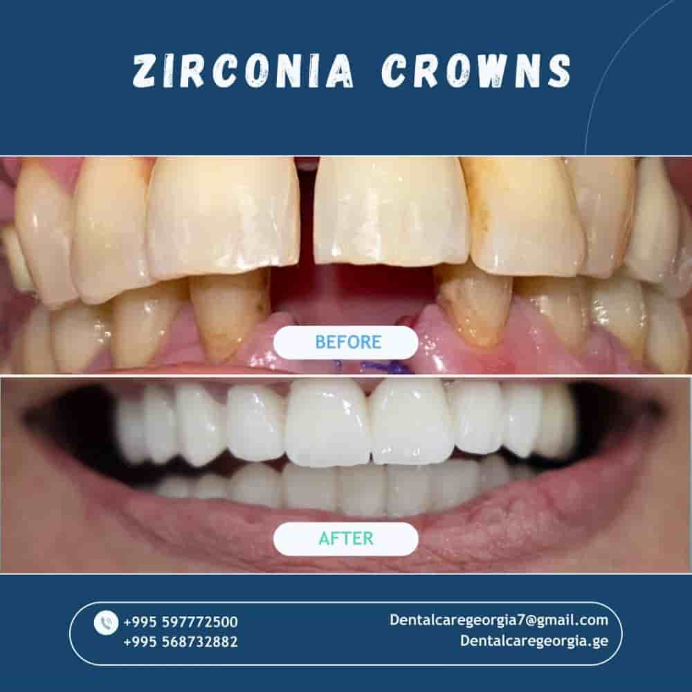 Подтвержденные отзывы пациентов о Universe Dental - Best Dental Clinic in Tbilisi, Georgia в Tbilisi, Georgia Slider image 5