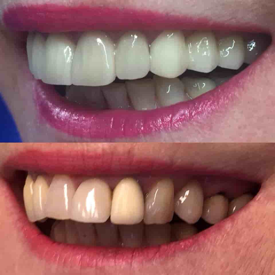 Подтвержденные отзывы пациентов о Dr. Erdal Kumkumoglu - Praktijk Istanbul в Istanbul, Turkey Slider image 3