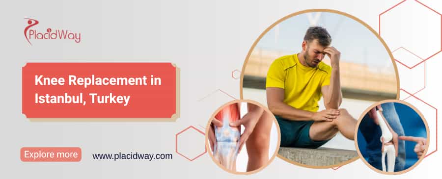 Замена коленного сустава в Стамбуле, Турция thumbnail