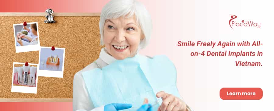 Дентальные имплантаты All-on-4 во Вьетнаме thumbnail
