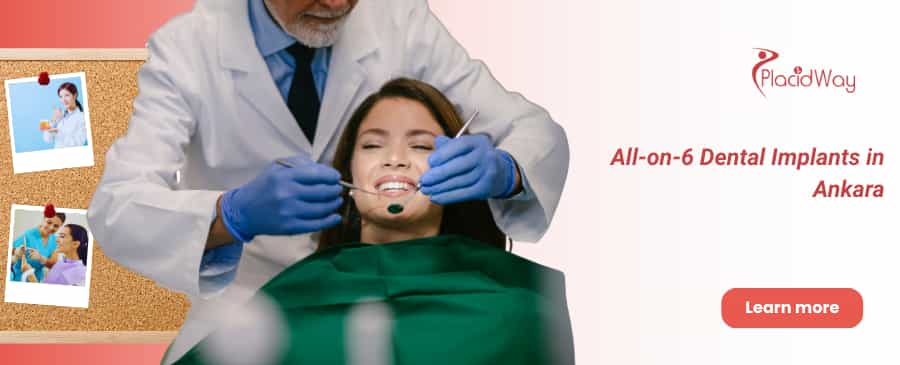 Имплантация All-on-6, Анкара, Турция thumbnail