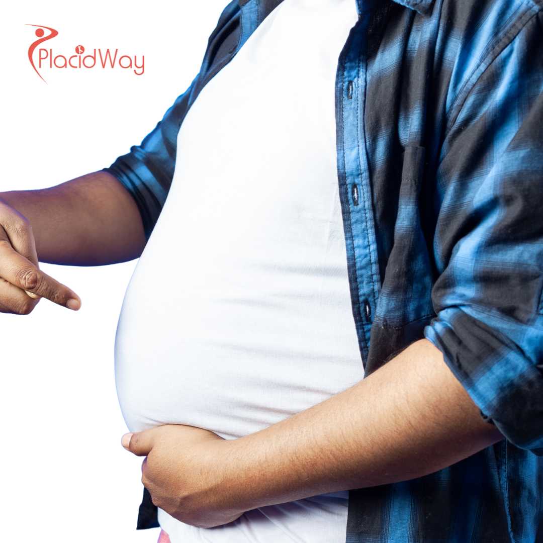 Липосакция 360° в Южной Корее для коррекции контуров всего тела и уменьшения жировых отложений.