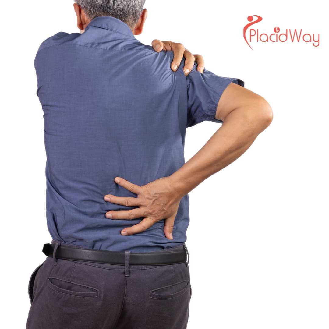 7 главных причин сделать операцию на вращательной манжете плеча в Турции