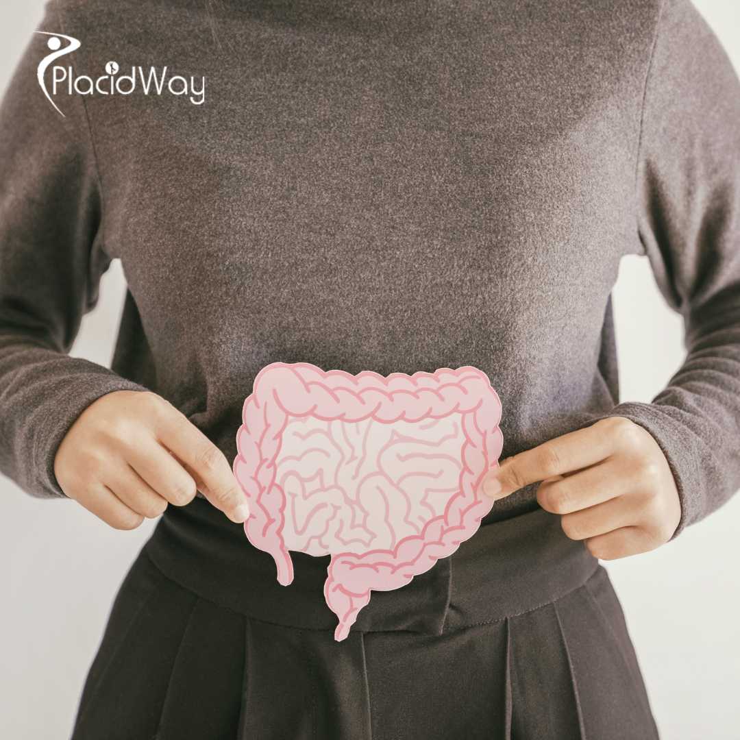 Мини-шунтирование желудка в Турции для пациентов, ориентированных на долгосрочное снижение веса.