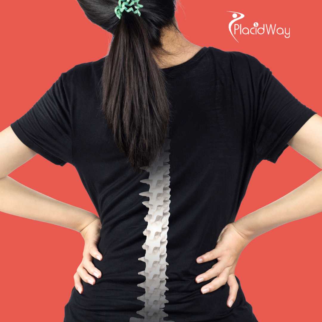 Хирургия позвоночника в Анкаре, Турция