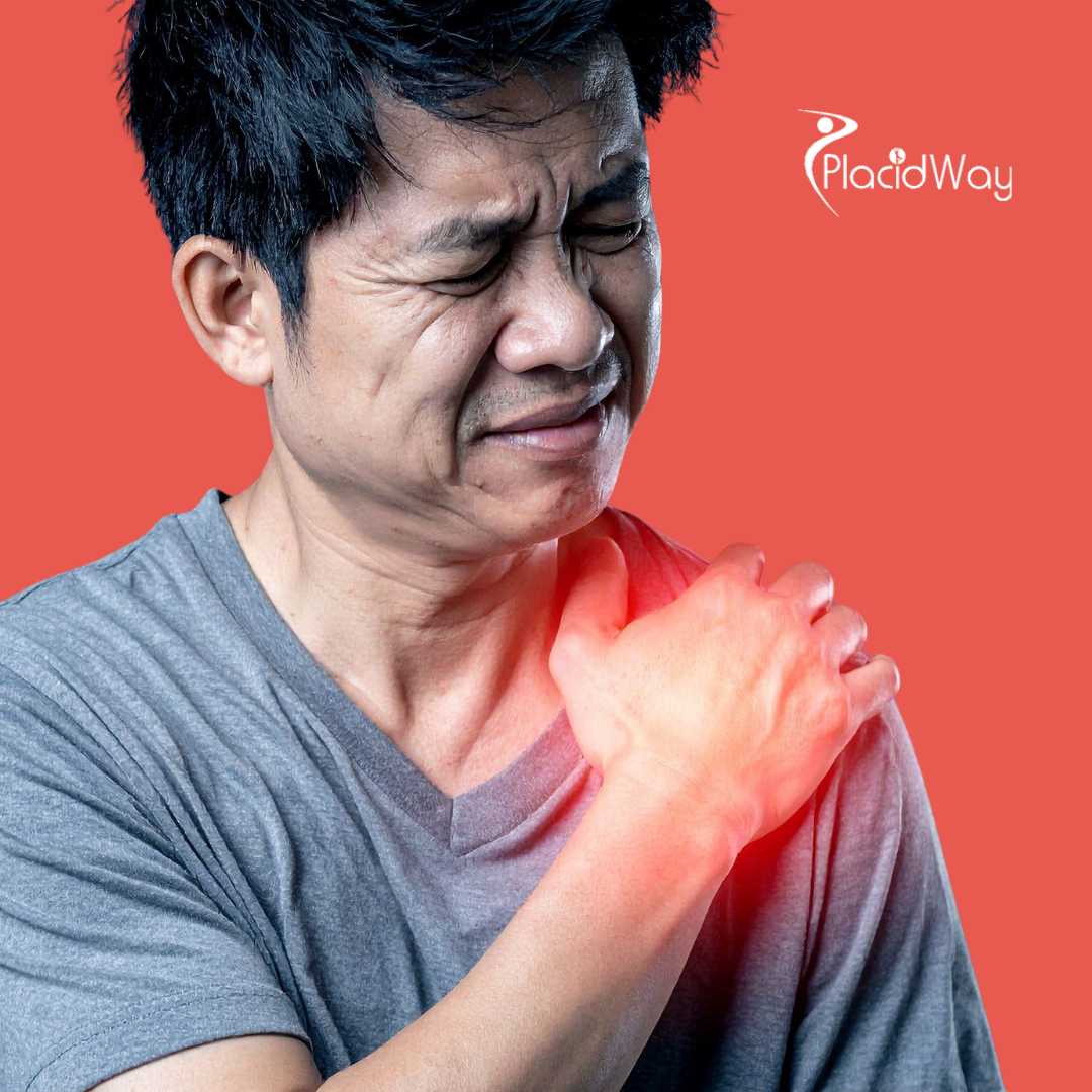 эндопротезирование плечевого сустава в Бурсе, Турция. 