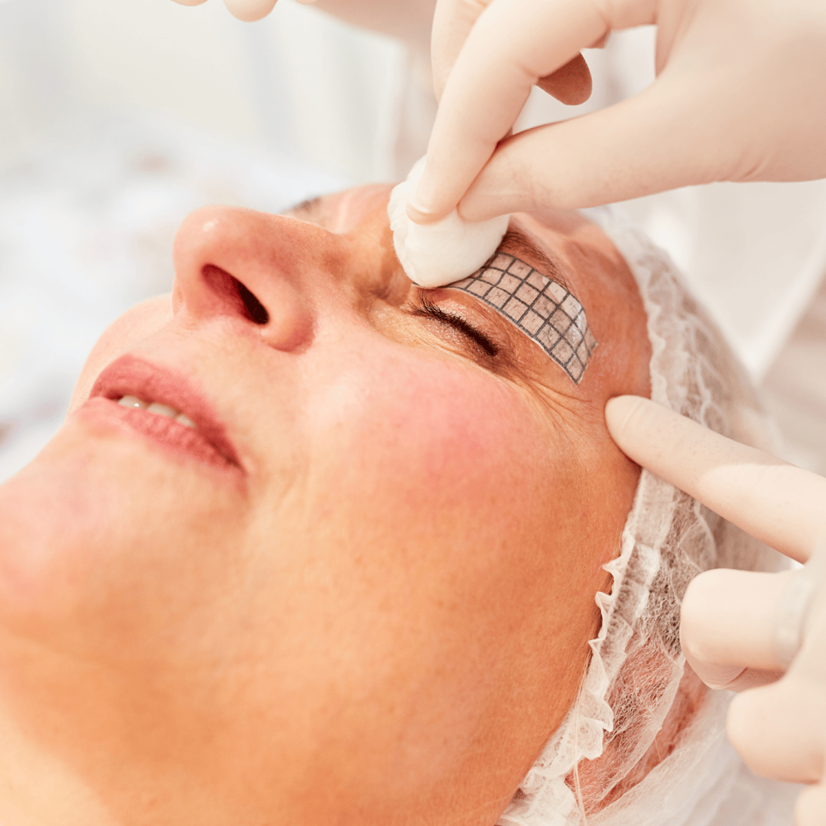 Почему китайские клиенты предпочитают операцию по созданию эффекта двойного века в Корее местным клиникам?