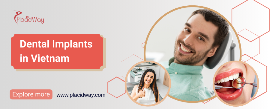 Зубные имплантаты во Вьетнаме
