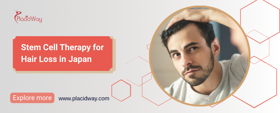 Терапия стволовыми клетками выпадения волос в Японии